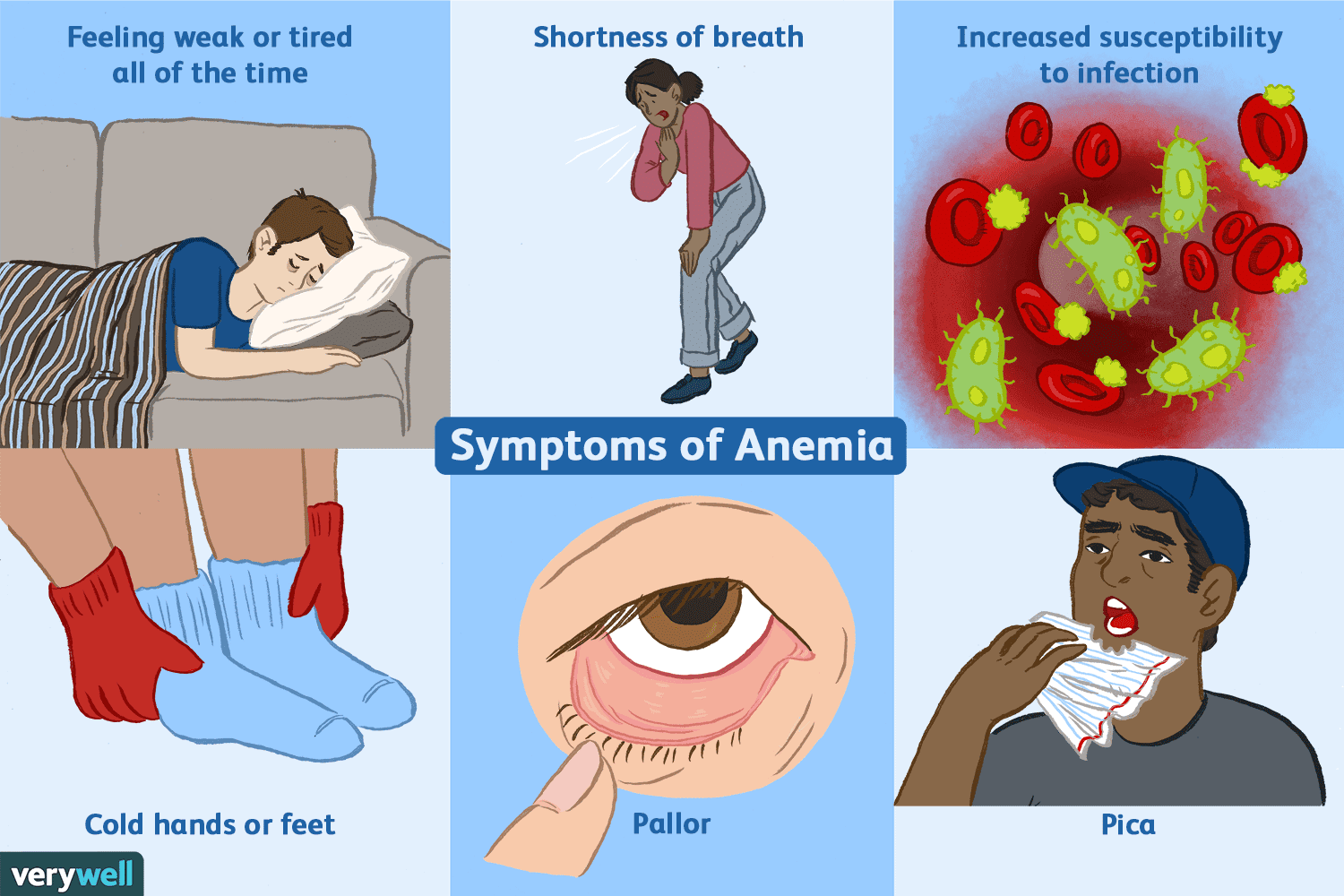 iron deficiency anemia symptoms