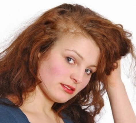 Easy Tips To Assist You Stop Loss Of Hair Soupkale02jasmine