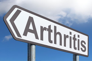 Arthritis Arthritis