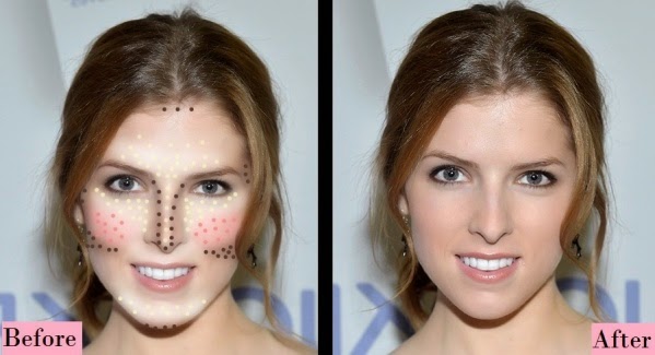 Correcciones rostro triángulo invertido