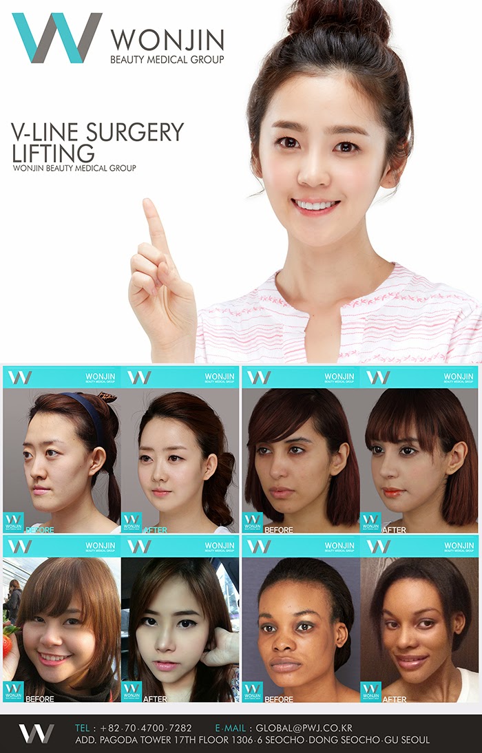 Best Plastic surgery in Korea?, Wonjin Beauty Medical Group ♥.