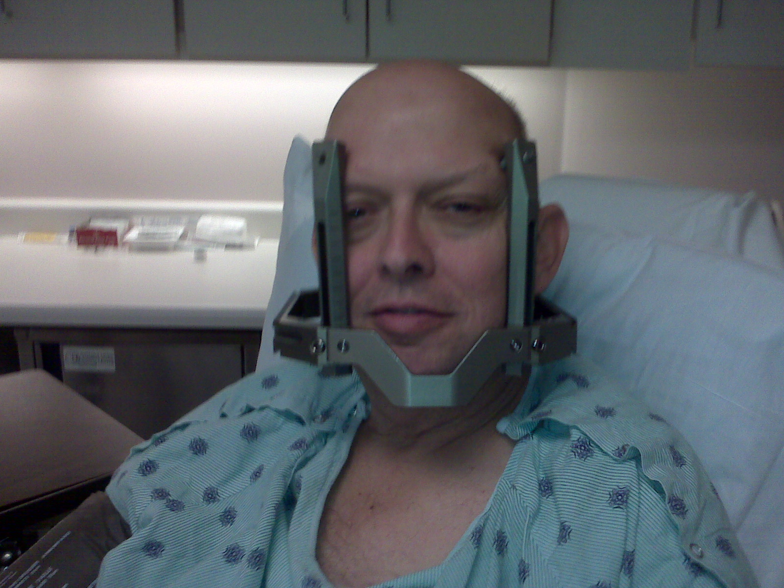 Jim Allen Lung Cancer Happens and we live on. 8/30 Gamma Knife