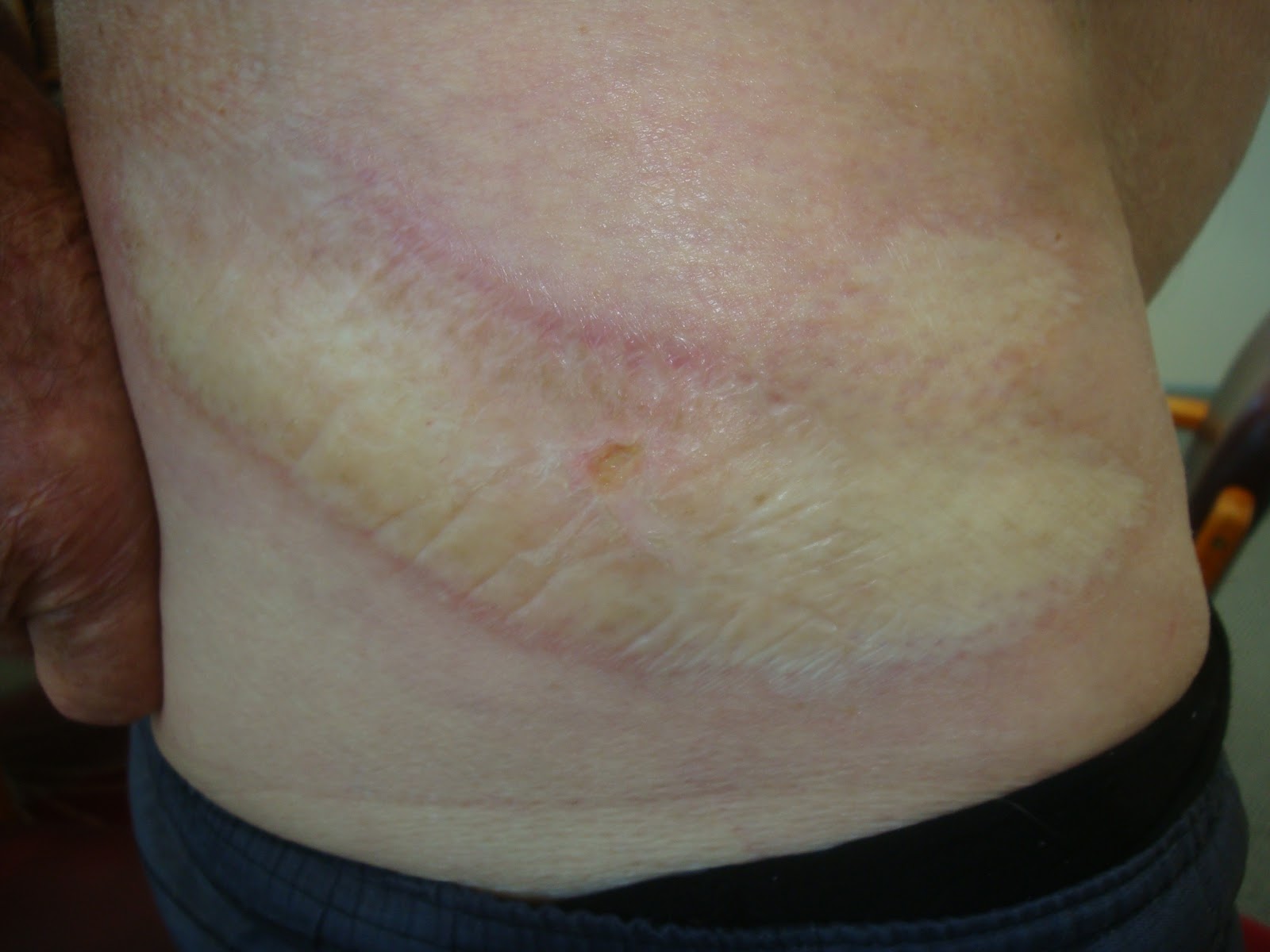 XXX Sex Photos Physical signs of anal intercourse