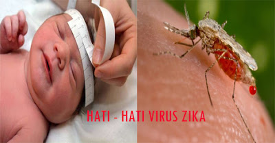 Bahaya Virus Zika Mengancam Ibu Hamil Dan Sang Bayi