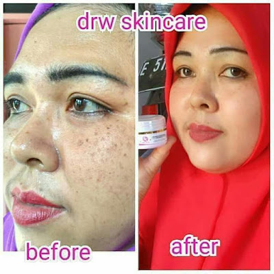 toko drw skincare trenggalek