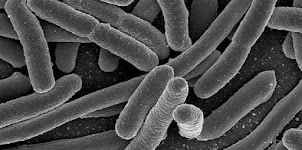 Enfermedades producidas por bacterias: 1 Escherichia Coli