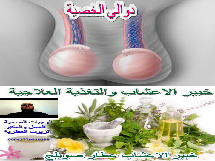 الخصية علاج الم في دوالي