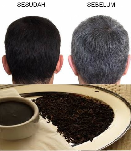 Kenapa Rambut Putih Di Usia Muda : Menurut sebuah penelitian yang