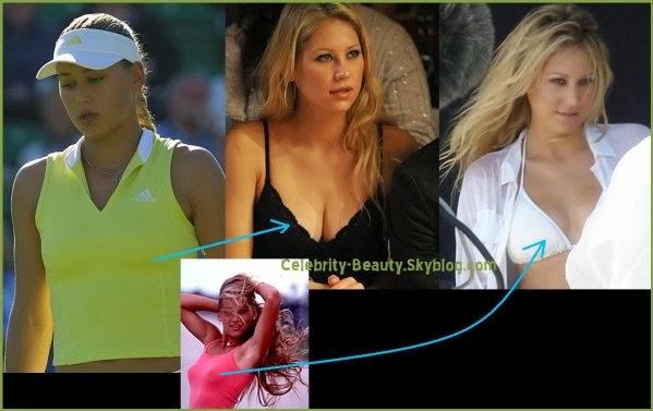 Cordia recommends best of Kournikova boob job XXX Sex Images Gay emo bdsm