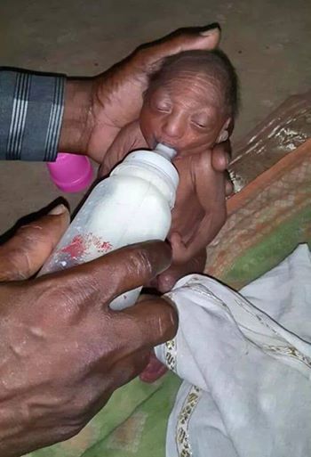 This little baby was rejected by his parents at birth