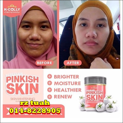 kcolly pinkish skin testi