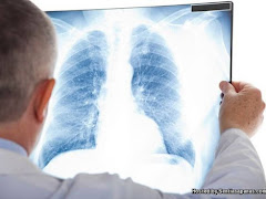 Bahaya Pneumonia, Jenis Dan Simptom Jangkitan Paru-paru