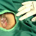 Obat Buang Air Besar Keras Untuk Balita thumbnail