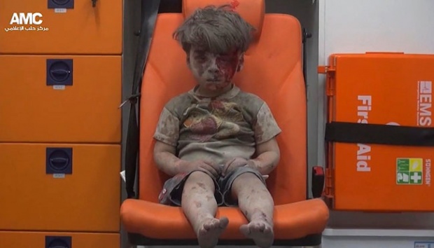 Tubuh Penuh Luka Akibat Serangan Bom,Foto Bocah Suriah Guncangkan Dunia