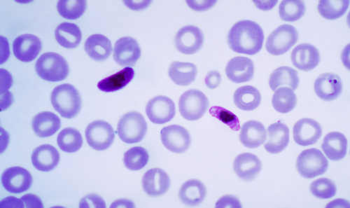 Protista Mirip Hewan (Protozoa) dan Contohnya Materi Biologi