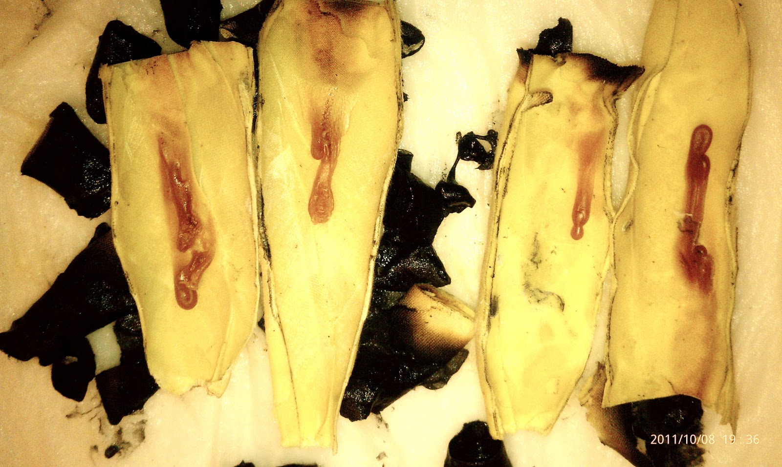 Unique Healings Ear Candling