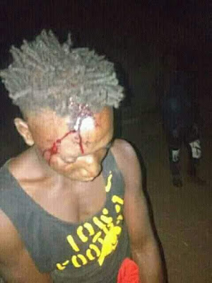 Photos: Many feared dead, scores injured as suspected Fulani herdsmen attack Benue community