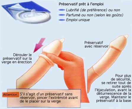 pr 233 vention de la grossesse et des ist les pr 233 servatifs pr 233 vention de la grossesse et des ist les pr 233 servatifs