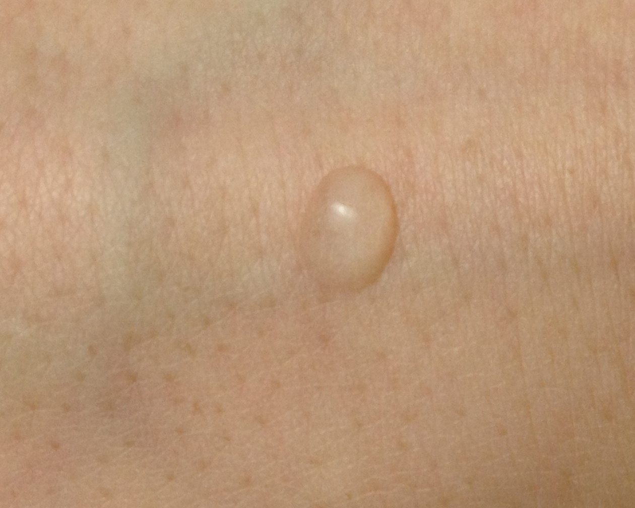 Etat Pur Citric Acid AHA - Beauty Geek
