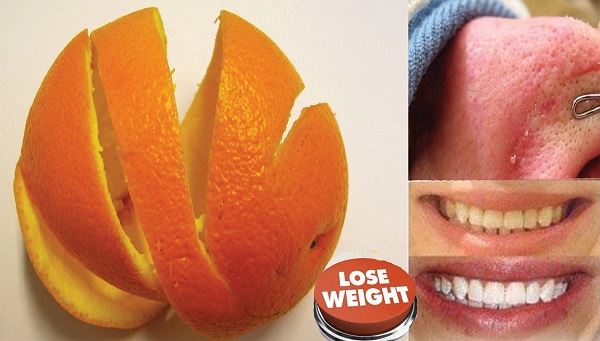 Never Throw Away The Orange Peels 3 Recipes To Lose Weight Whiten