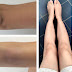 Effective Natural Remedies to Lighten Dark Elbows and Knees