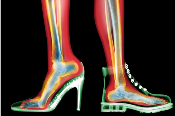 High+Heel+and+Boot+X-Ray.jpg
