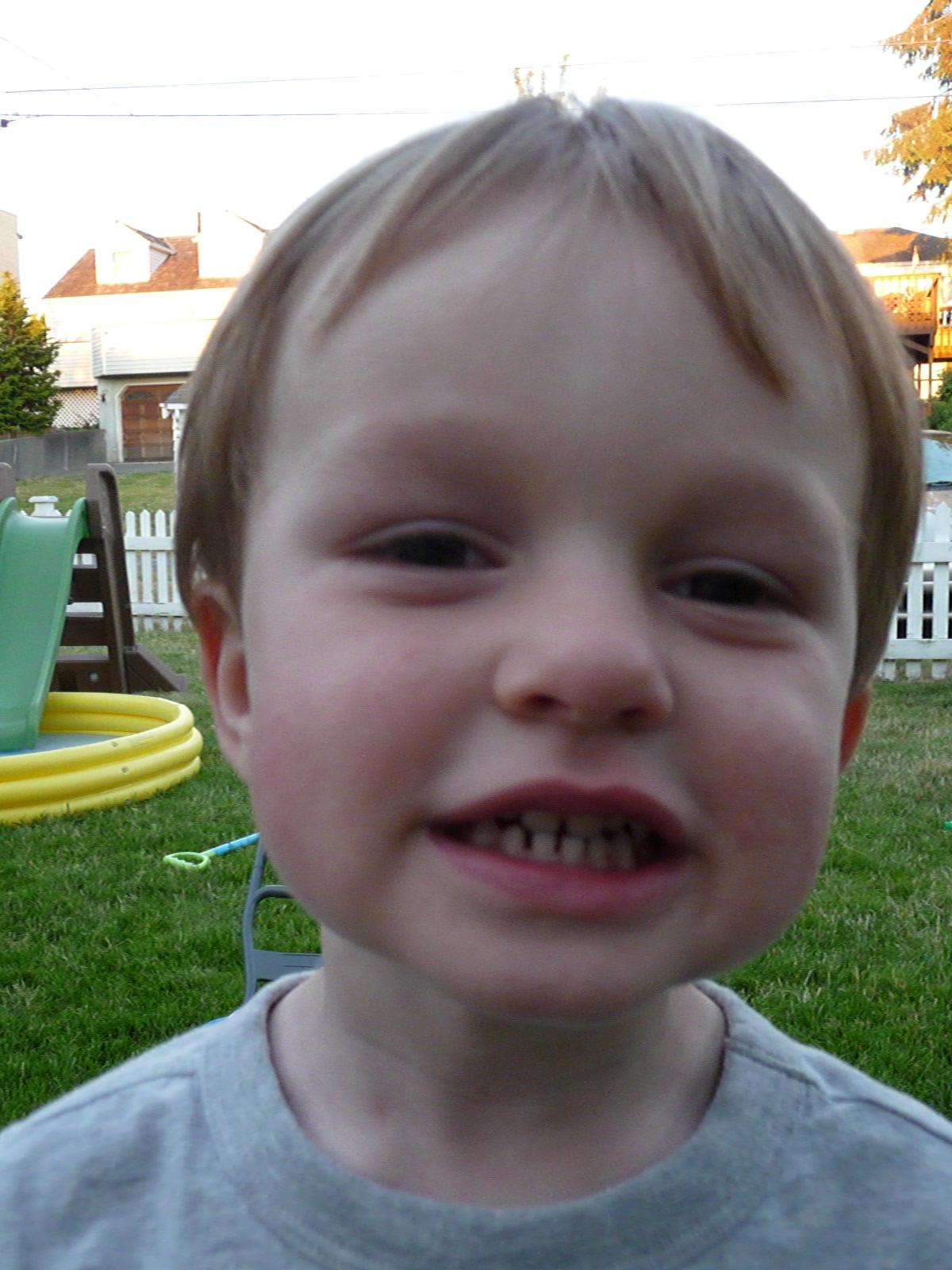 How To Fix Underbite In Toddler / Can Poodles Have an Underbite? Should