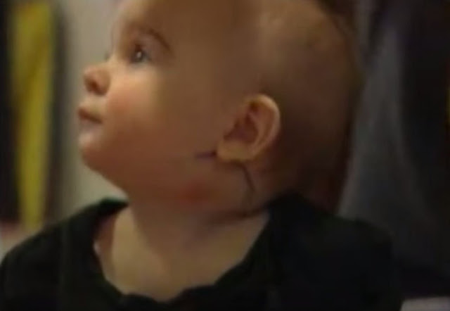 Dokter Terkejut Melihat Muka Bayi 7 Bulan ini, Anda Pasti Kasihan Melihatnya Dokter Terkejut Melihat Muka Bayi 7 Bulan ini, Anda Pasti Kasihan Melihatnya