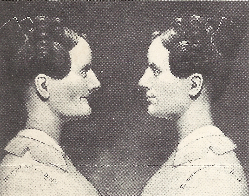 Looking Back on Dentistry: A very old Advertisement showing how ...