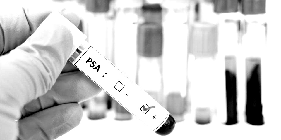 psa antígeno prostático específico a medida que engorda