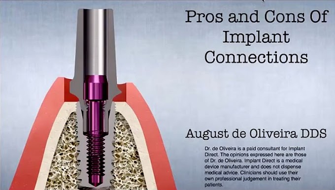 WEBINAR: The Evolution of Implant Connections - Dr. August de Oliveira