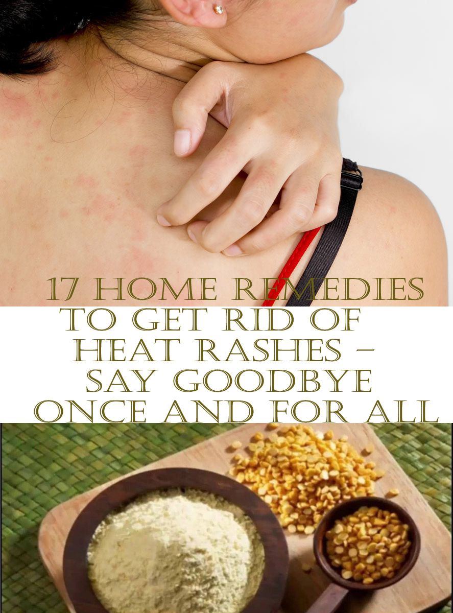 How to Get Rid of a Rash ? note in beauty