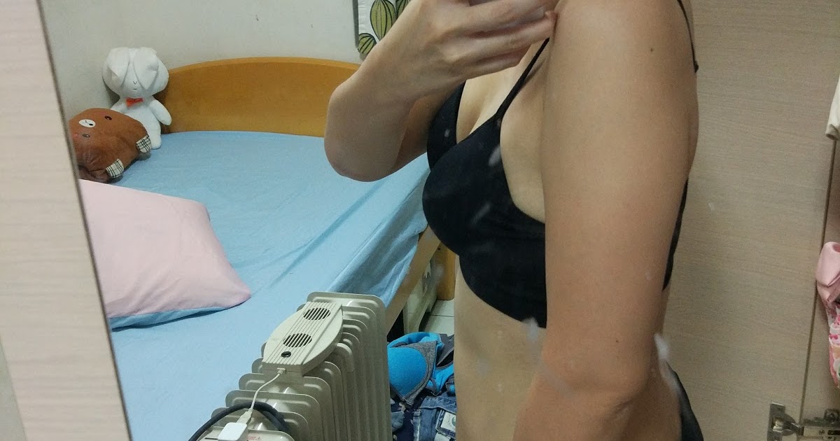 [討論] 手臂抽脂要做威塑還是雷射減脂