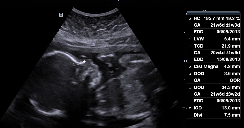 21 неделя. 21неделья беременности. Week 21. Размер живота на 21 неделе беременности. Week 21.