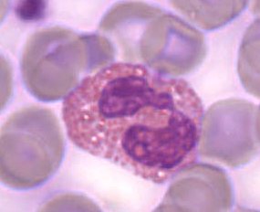 InfoSemata: Jenis jenis Leukosit Jenis jenis Leukosit | InfoSemata