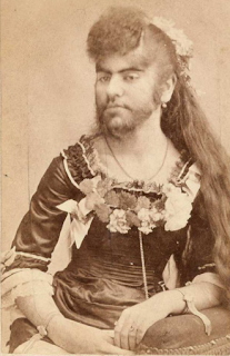 Bearded Woman