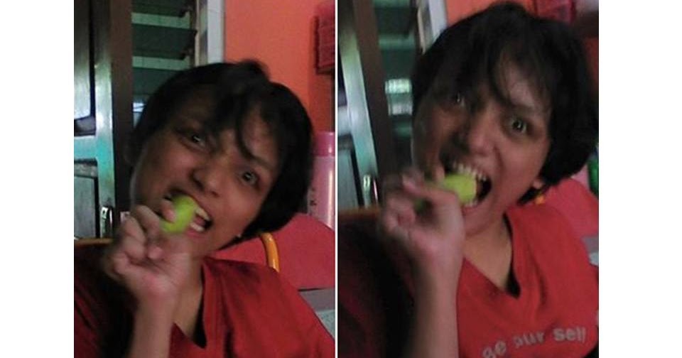 cerebral palsy, lumpuh otak (terapi dibarengin brainking plus progress