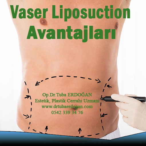 Блефаропластика верхних век в ростове