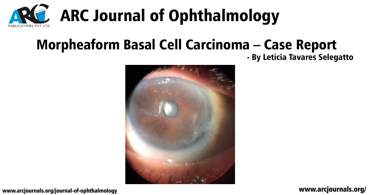 Morpheaform Basal Cell Carcinoma Case Report ARC Journal of