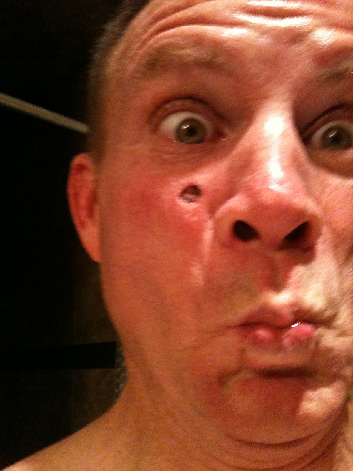 free-download-red-scaly-patch-on-my-face-programs-nanobittorrent