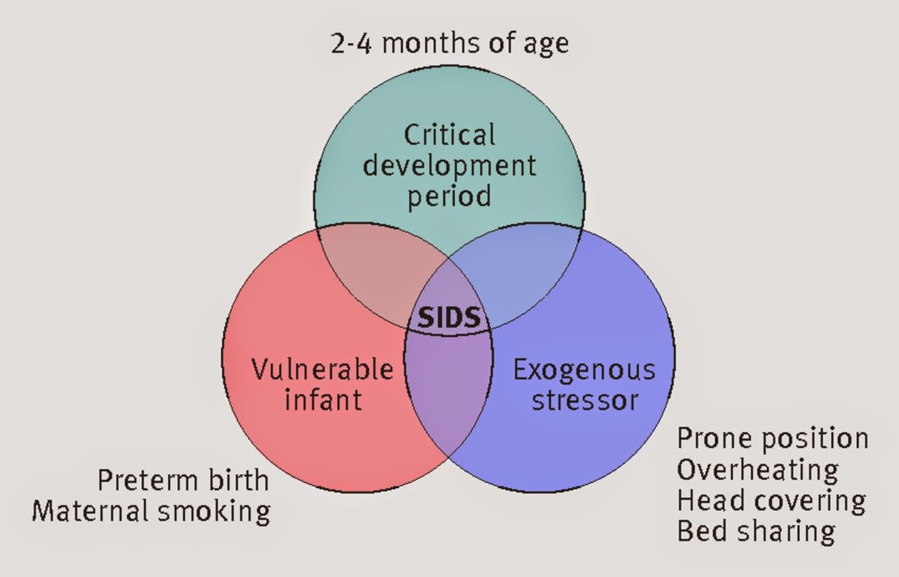 家庭医・医学教育研究者の省察的実践録 乳幼児突然死症候群を防ぐには(BMJ)
