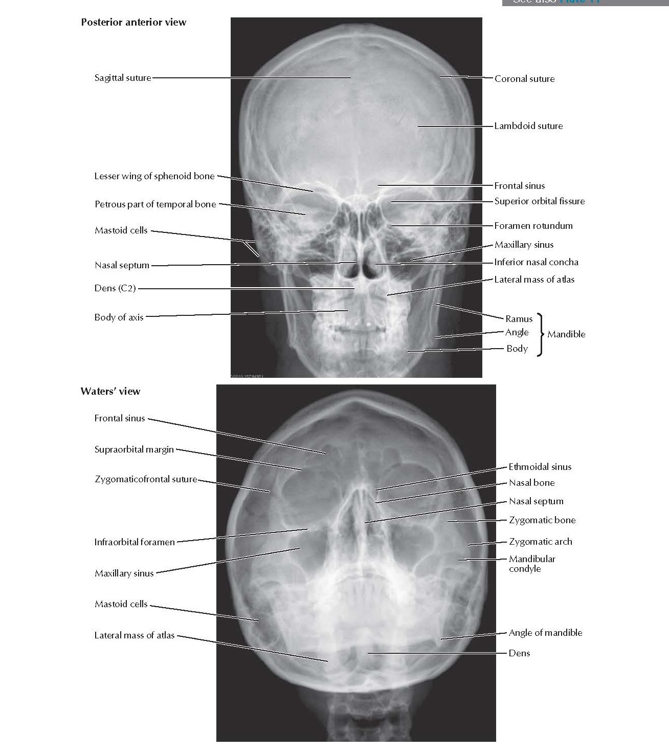 Skull Radiographs Anatomy pediagenosis