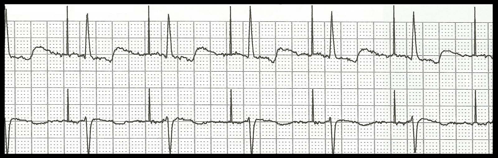 Float Nurse: Basic EKG Rhythm Test 04