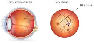Hallucinations in peripheral vision Hallucinations in peripheral vision