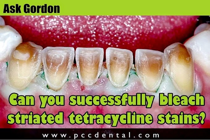 BLEACHING: Can you successfully bleach striated tetracycline stains?