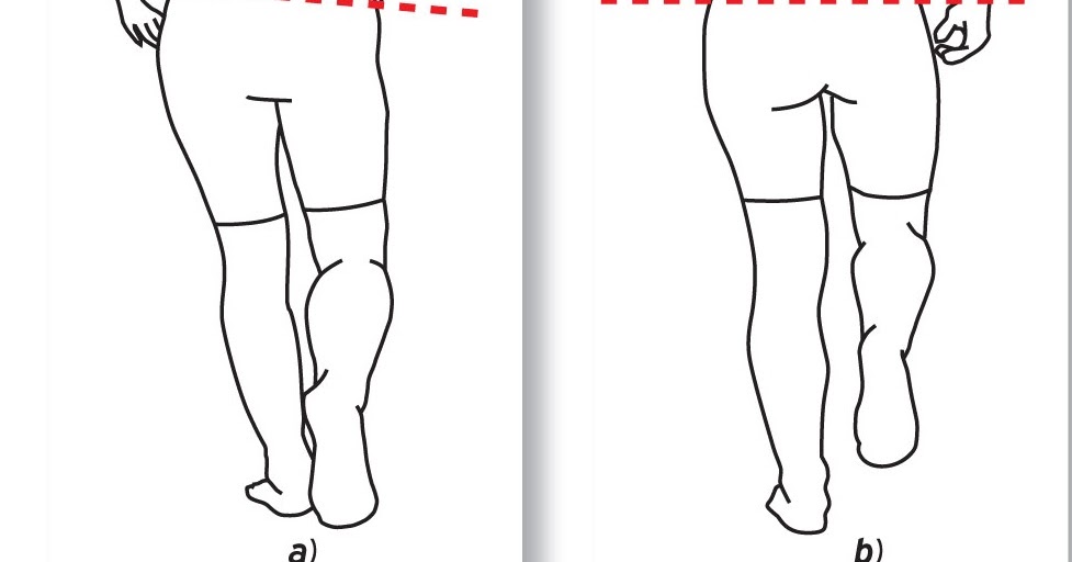 Thinking and Running Trendelenburg Gait and Running Injuries