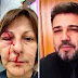 Marco Feliciano diz a professora agredida: “quem planta o ódio, colhe o ódio”