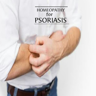 HOMEOPATHY FOR PSORIASIS 