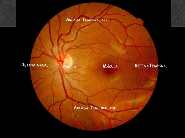 Ceo Óptica Ecuador  Para qué sirve el examen de fondo de ojo El estudio  del fondo de ojo es muy importante para detectar ciertas patologías graves  en sus fases iniciales Se