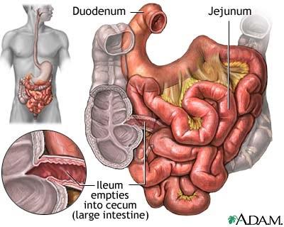 condiloame ale intestinului gros)